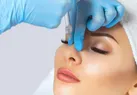 چگونه می توانم بدون جراحی شکل بینی خود را تغییر دهم؟