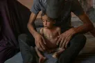 گزارش سخنگوی سازمان ملل از تشدید گرسنگی و سوء تغذیه در غزه
